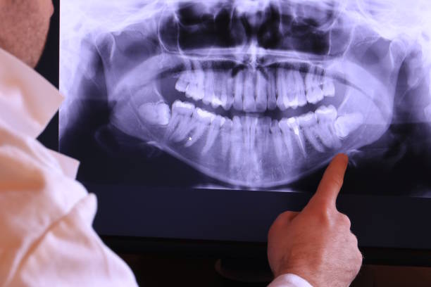 Best Emergency Denture Repair in Valley Falls, RI