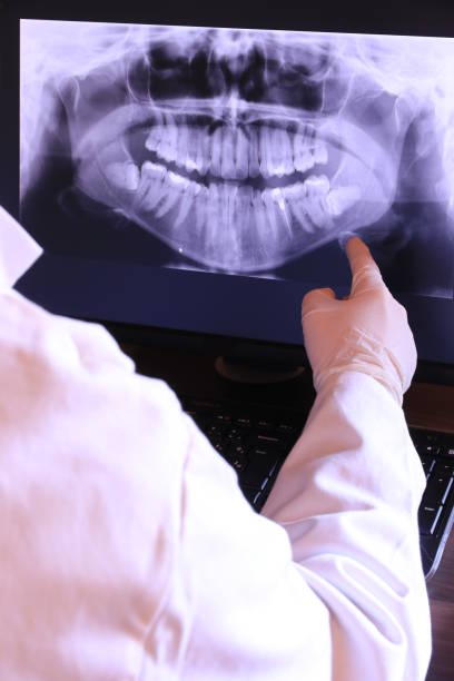 Best Emergency Gum Treatment in Valley Falls, RI